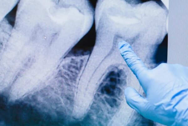 damaged tooth